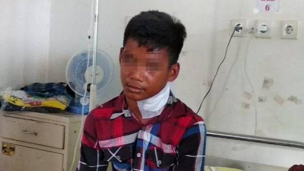 Un joven indonesio es apuñalado en el cuello por un pez aguja (y vive para contarlo)