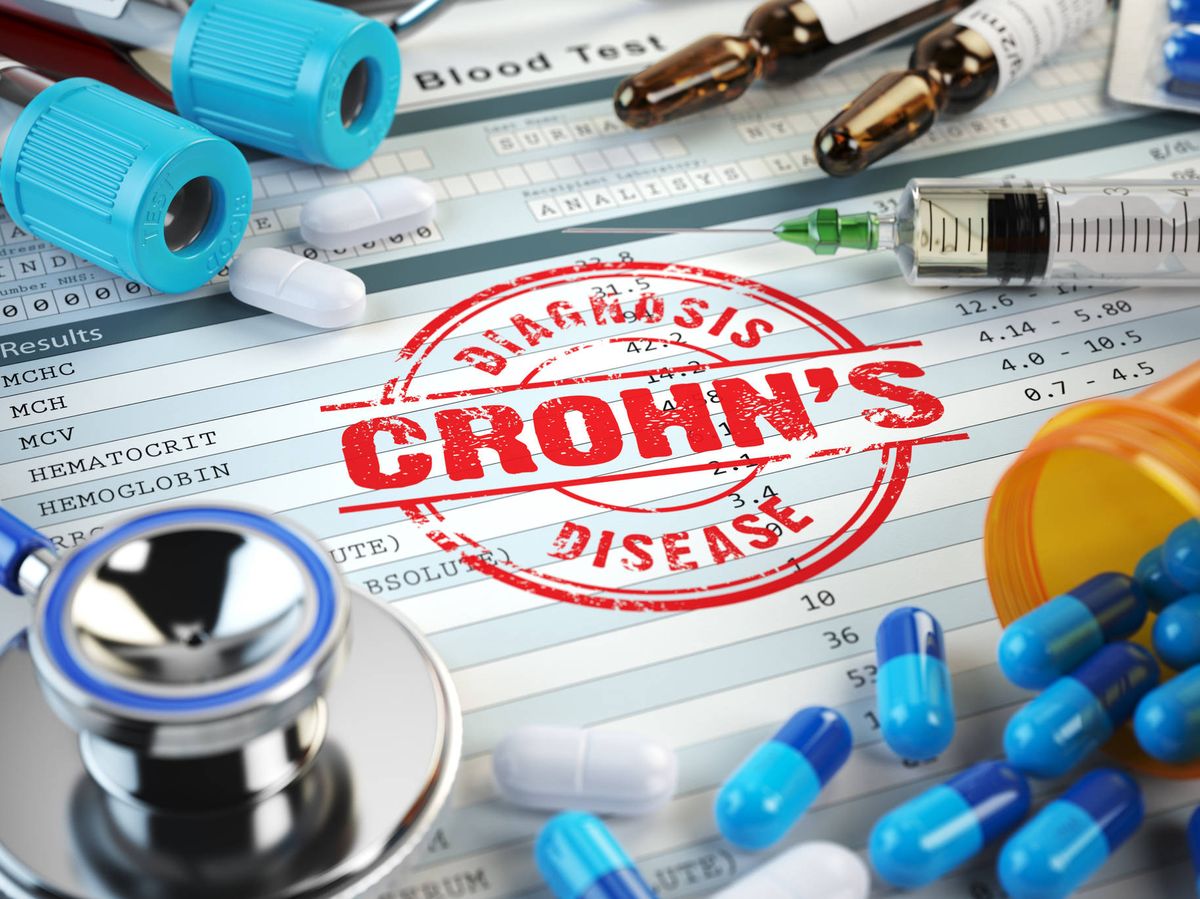 Foto: La enfermedad de Crohn puede tener otras manifestaciones extradigestivas. (iStock)