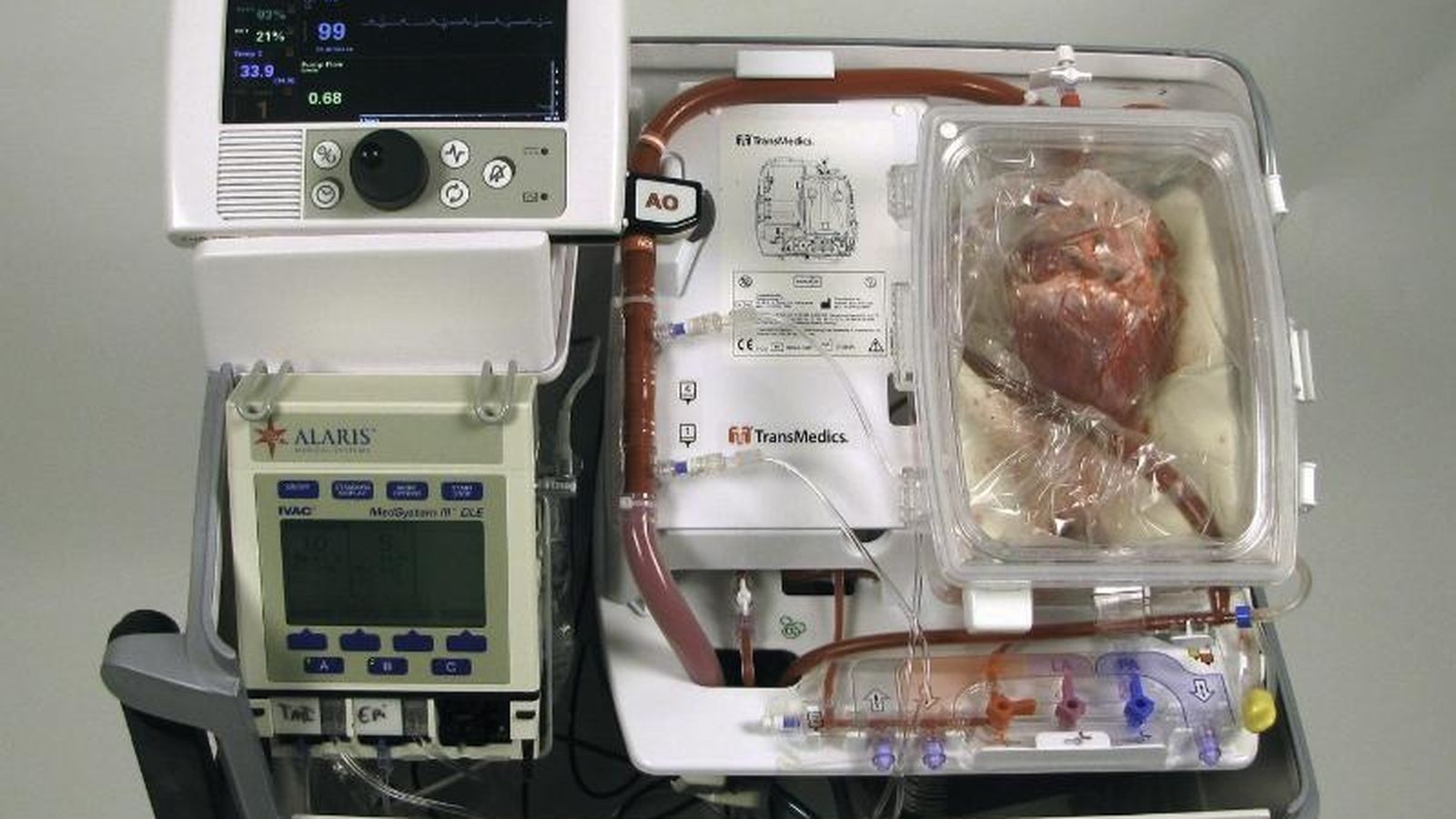 Foto: Máquina desarrollada por TransMedics que permite el trasplante de corazón desde un donante fallecido (PRNewsFoto/TransMedics) 