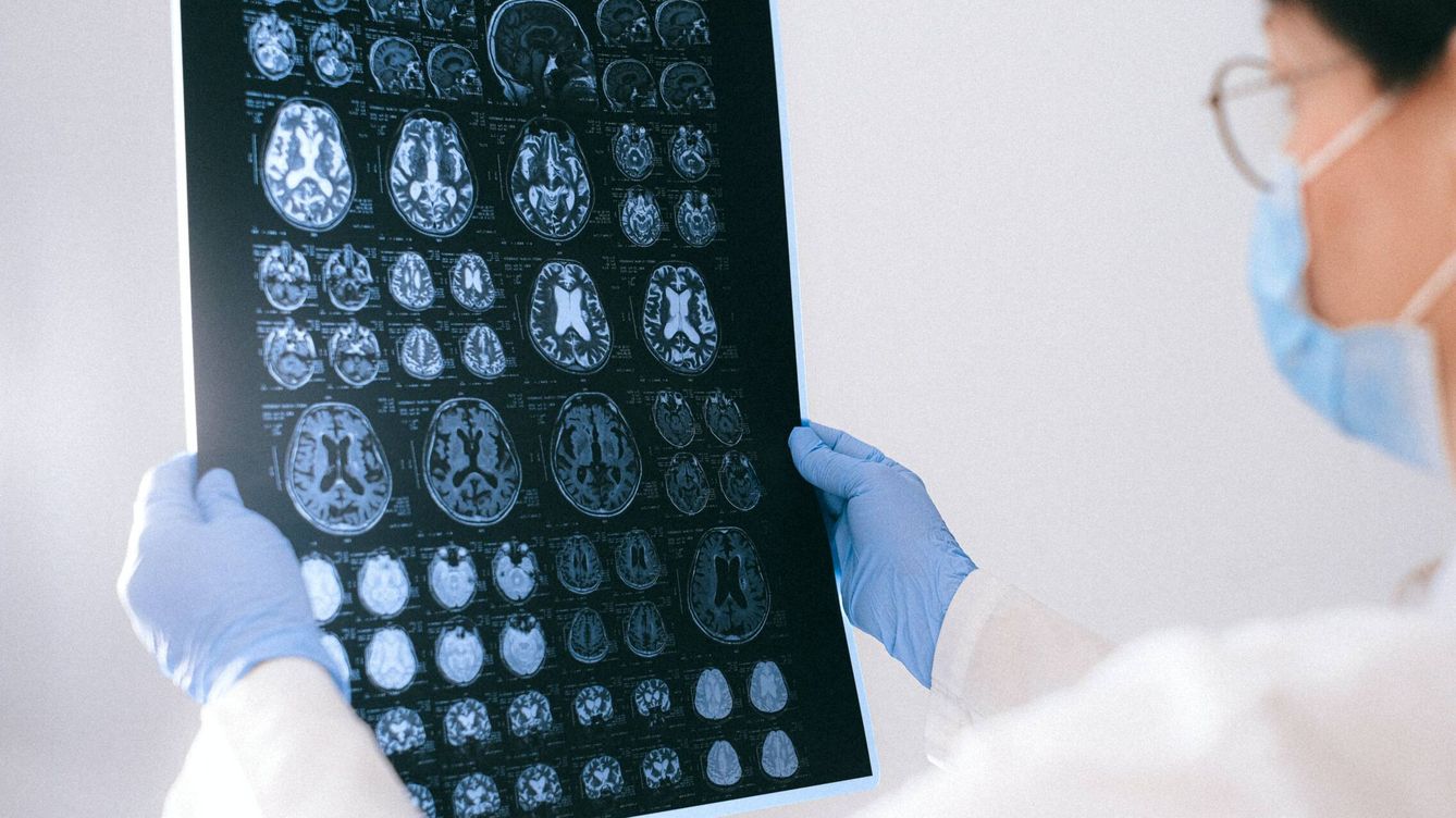 Un nuevo 'wearable' podría detectar los primeros signos de alzhéimer mientras dormimos