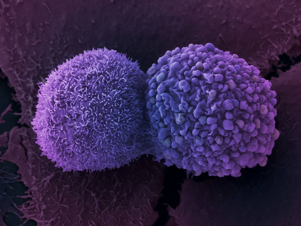 Foto: Células de cáncer de pulmón (Foto: Anne Weston / Francis Crick Institute)