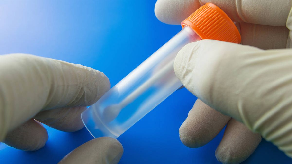 Cosas que hay que saber antes de hacerse un test de microbiota