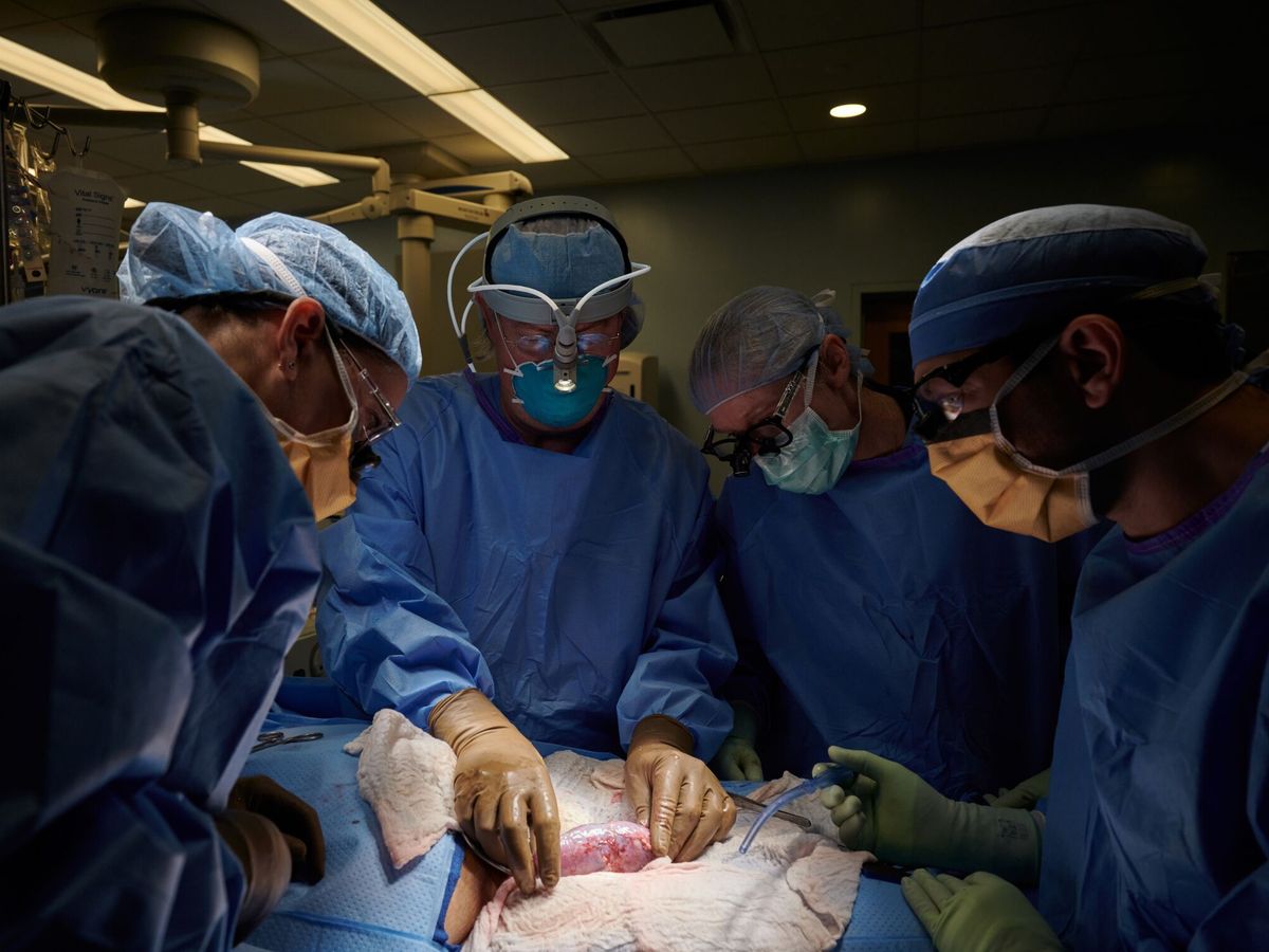 Foto: Médicos consiguen trasplantar un riñón de cerdo a un humano en Nueva York. (EFE/NYU Langone Health/Joe Carrotta) 