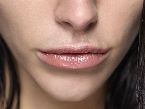 Migración del relleno de labios: cómo evitar que el ácido hialurónico ...
