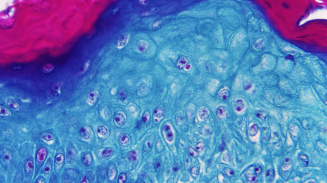 Foto: Imagen ampliada con un microscopio de una muestra de piel de un mono infectado con el virus de la viruela del mono. (EFE)
