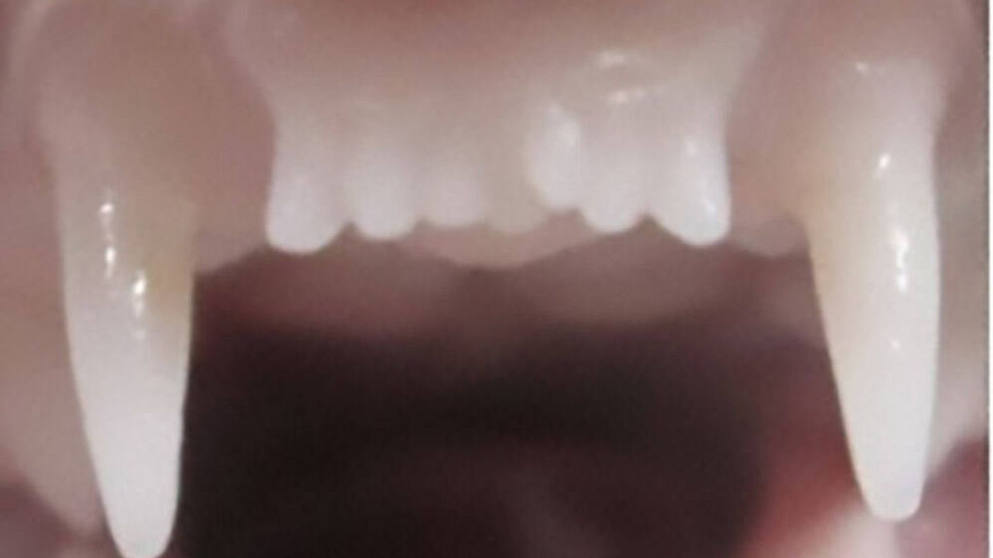 El nuevo diente delantero de un hurón tratado con el medicamento. (Katsu Takahashi )