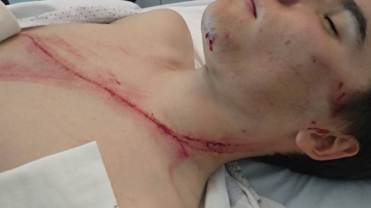 El terror de la bicicleta: un quitamiedos casi degüella a un ciclista en el País Vasco
