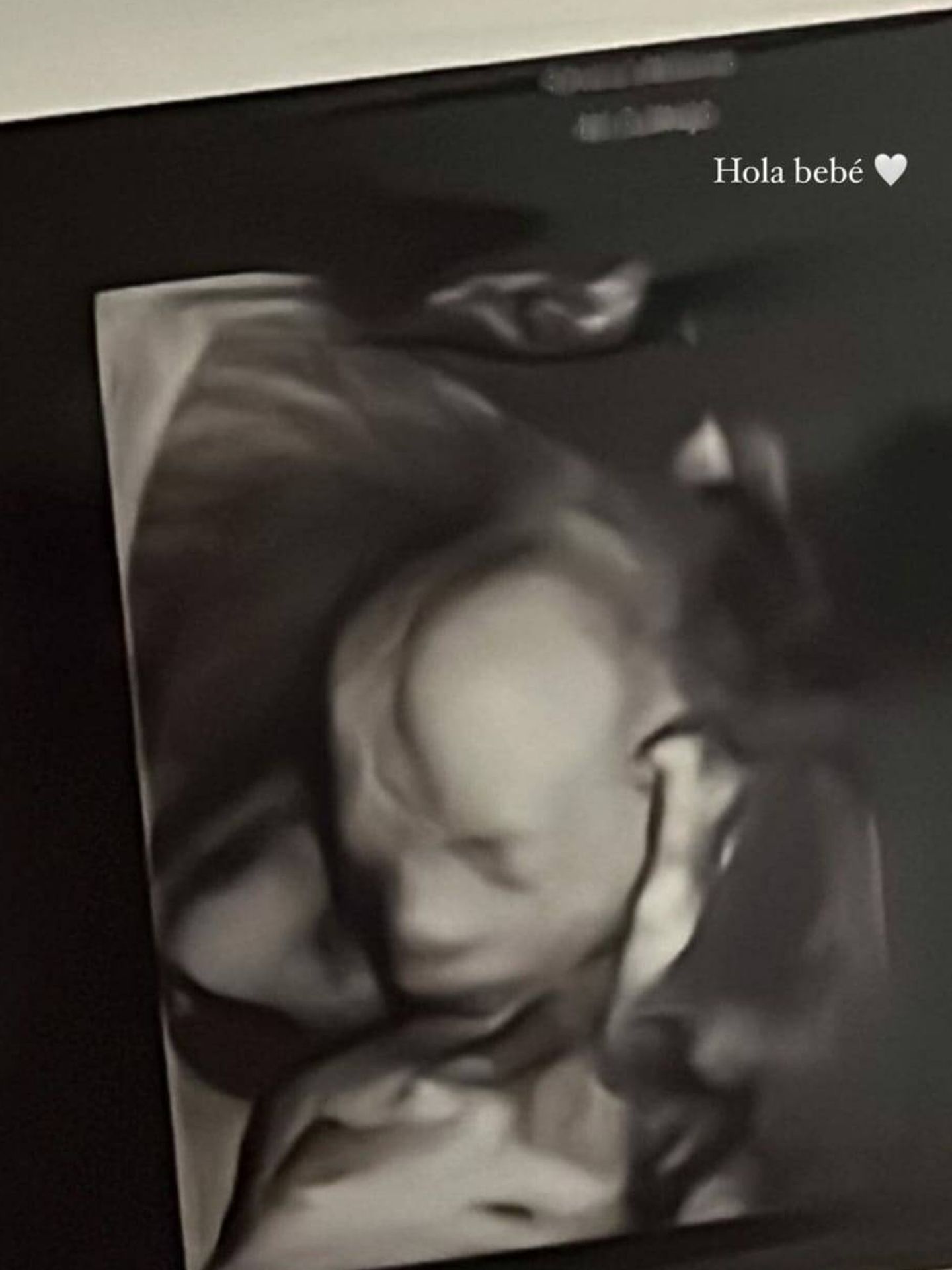 El bebé de Sandra Gago y Feliciano López en una ecografía. (Instagram/@sandragago_)