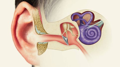 Oídos taponados: causas y qué debes hacer y qué no para solucionarlo