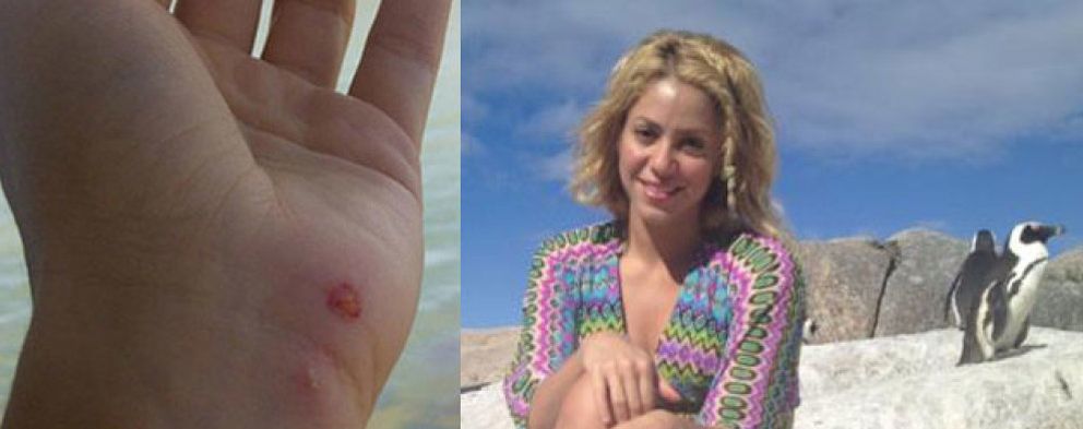 Foto: El accidentado comienzo de semana de Shakira y Piqué