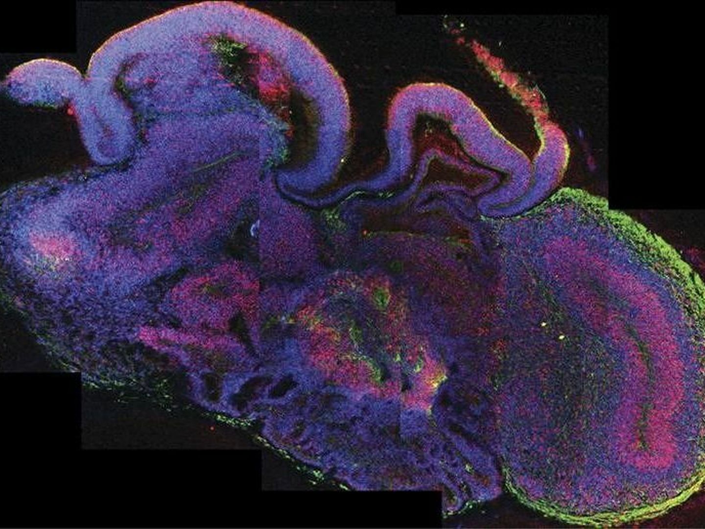 Muestra del desarrollo de las diferentes regiones del cerebro, con todas las células en azul, las células madre neuronales en rojo y las neuronas en verde