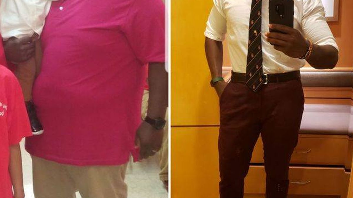 Comió los mismos alimentos durante años y adelgazó 65 kilos