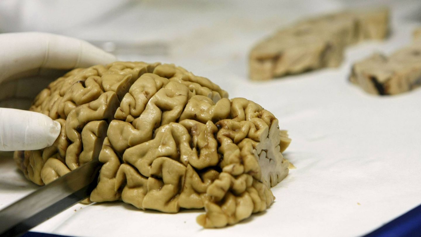 Cerebro de un banco de tejidos neurológicos. (EFE)