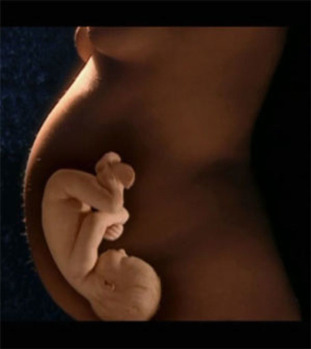 Foto: Un test de sangre materna mostraría enfermedades heredadas en el feto