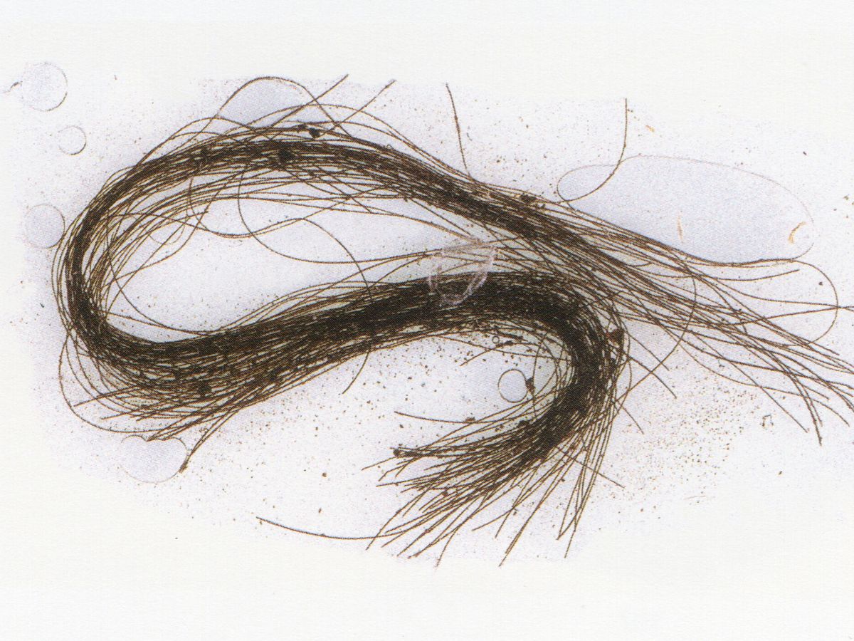 Foto: Un mechón de pelo de hace casi 3.000 años bastó para lograr la primera evidencia directa del uso en Europa de drogas. (EFE/Universitat Autònoma de Barcelona)
