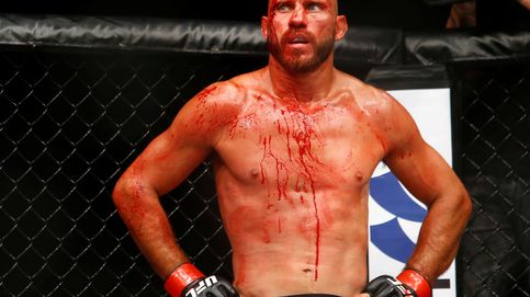 Cerrone acaba bañado en sangre en la UFC, pero tiene cuerda para rato