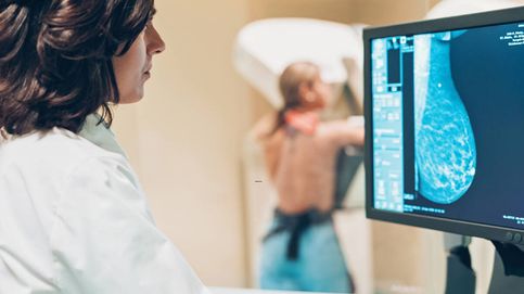 Recaída en el cáncer de mama: ¿es posible identificar a las pacientes con más riesgo?