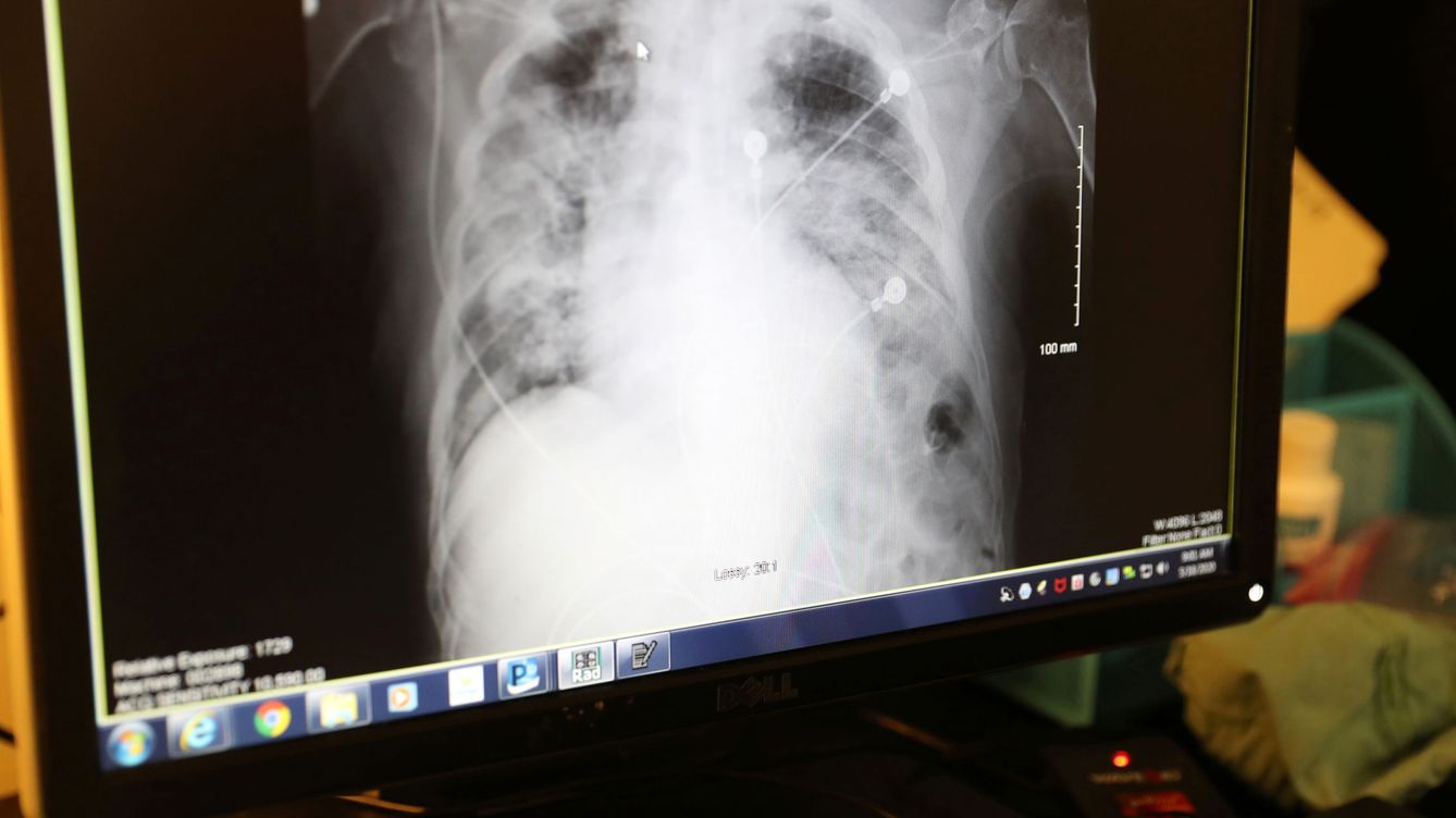 Foto: El 'radiólogo' de inteligencia artificial podría llegar a los hospitales en 2023. (Reuters)