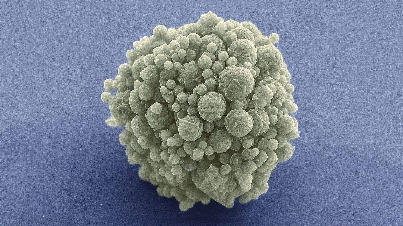 Foto: La célula sintética creada por el JCVI con 473 genes. (NCIMR)