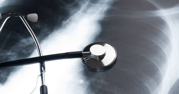 Foto: Radiografía pulmonar. (iStock)