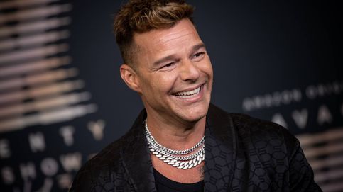 ¿Qué le ha pasado a Ricky Martin? Los expertos analizan su 'nuevo rostro'