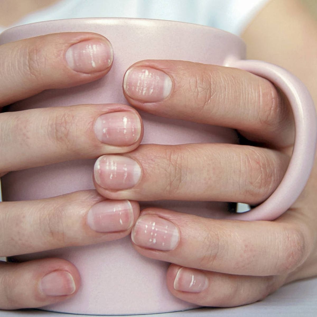 Las uñas dicen mucho de lo que le pasa a tu salud, advierte un dermatólogo