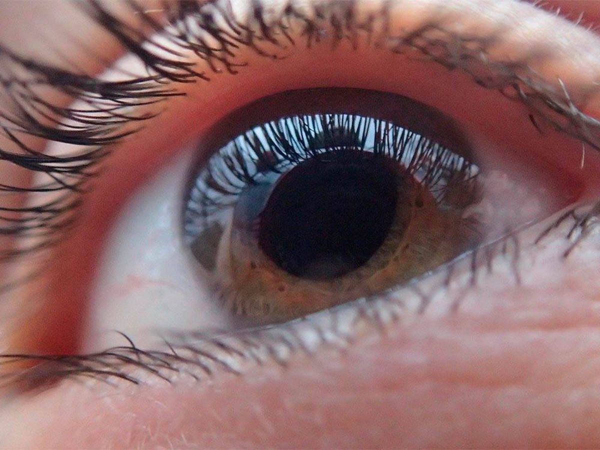 Foto: Una mujer ciega recupera la visión gracias a investigadores españoles (Pixabay)