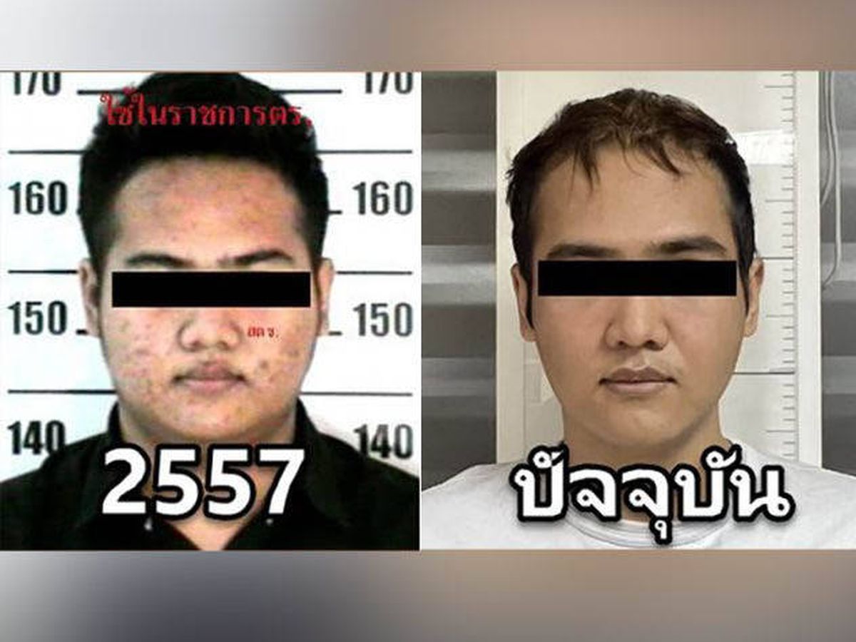 Foto: Traficante de drogas tailandés se opera como 'hombre coreano' para que no le pillen (Policía Real de Tailandia)