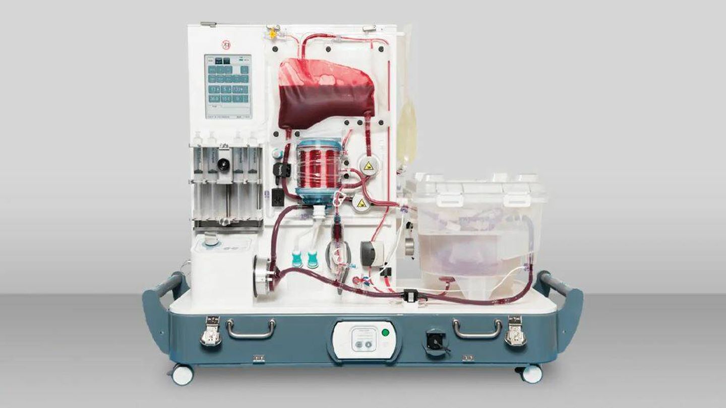 Una máquina de preservación de hígados. (OrganOx)