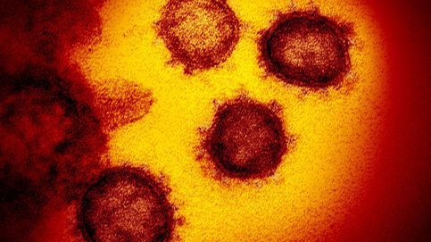 ¿Ha sido el coronavirus creado en un laboratorio? La respuesta corta es no