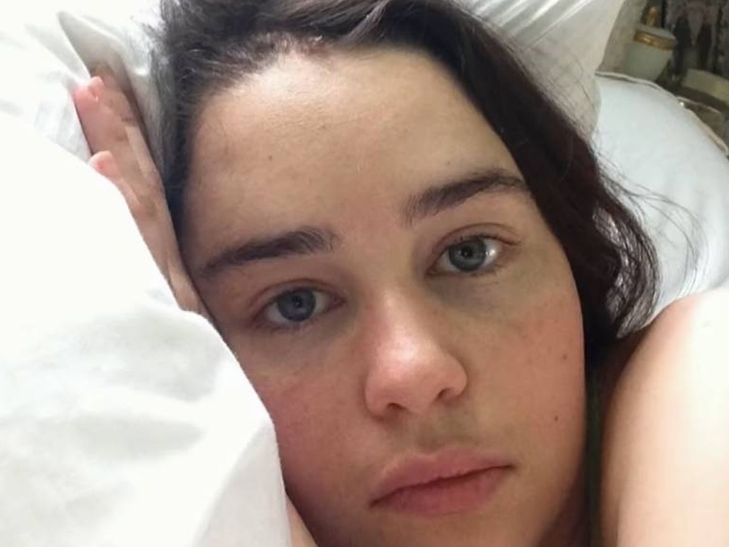 Emilia, en el hospital. (CBS This Morning/Youtube)