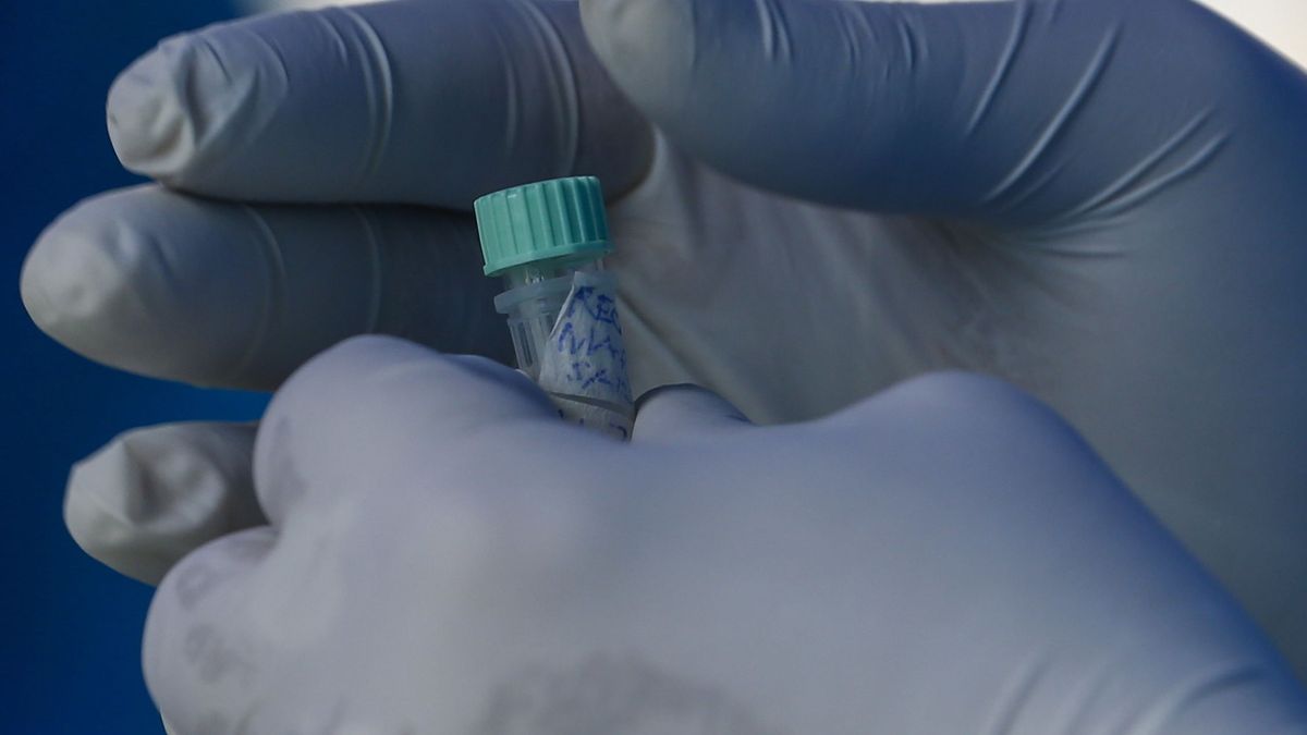 La tecnología CRISPR, una posible prueba del covid "simple" como un test de embarazo