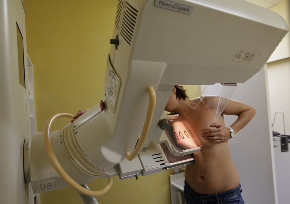 Foto: Una mujer se somete a un escáner mamográfico. (Reuters)