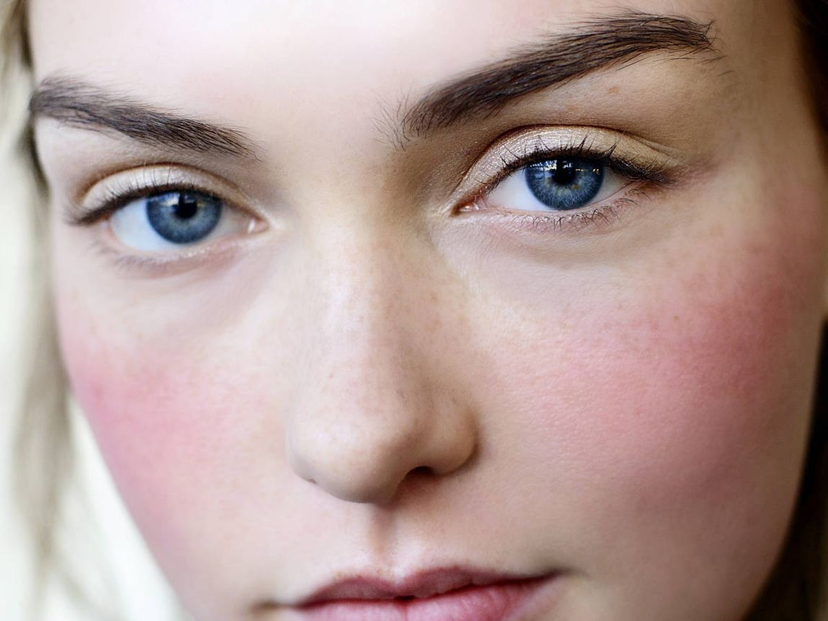 Foto: Cómo cuidar una piel sensible y con acné. (Imaxtree)
