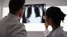 Pacientes y profesionales sanitarios ponen voz a la fibrosis pulmonar en 'Más allá del pulmón'
