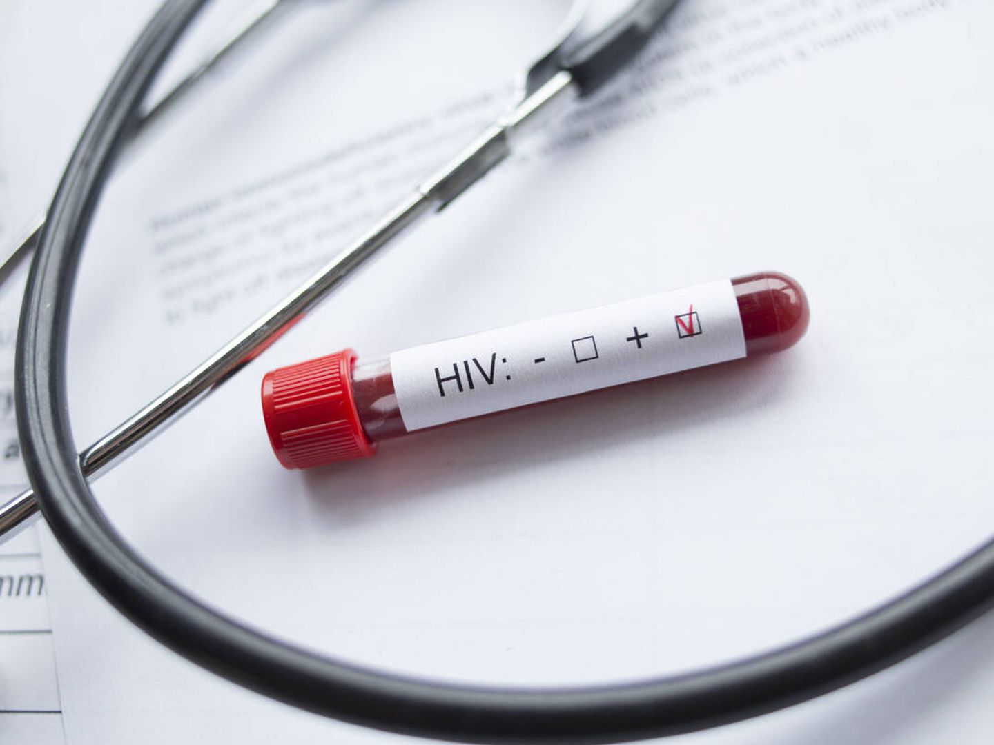 Test de VIH en sangre. (iStock)
