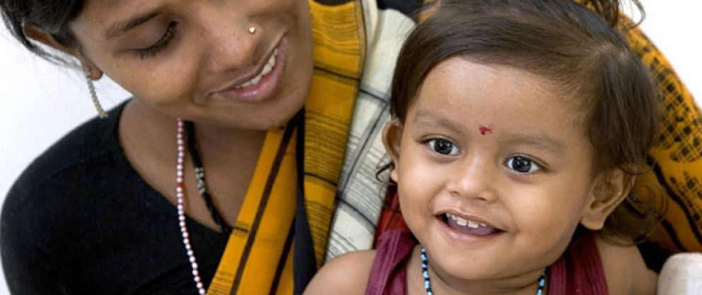 Foto: La niña india que nació con ocho extremidades, estable tras una operación de más de 24 horas