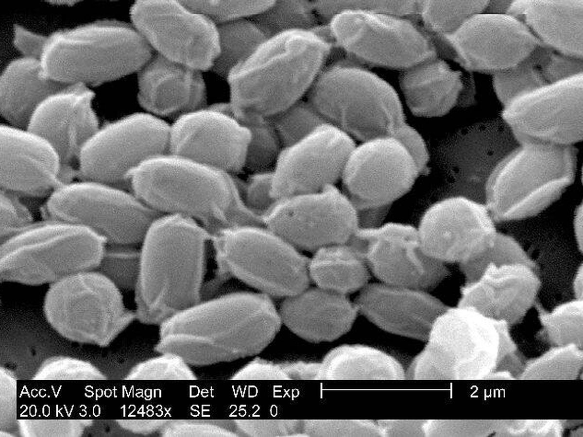 Foto: Esporas de bacillus anthracis en el microscopio (CC-Wikimedia)