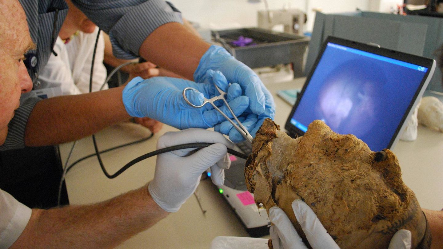 El equipo extrae el diente para realizar las pruebas de ADN. (Museo de Bellas Artes de Boston)