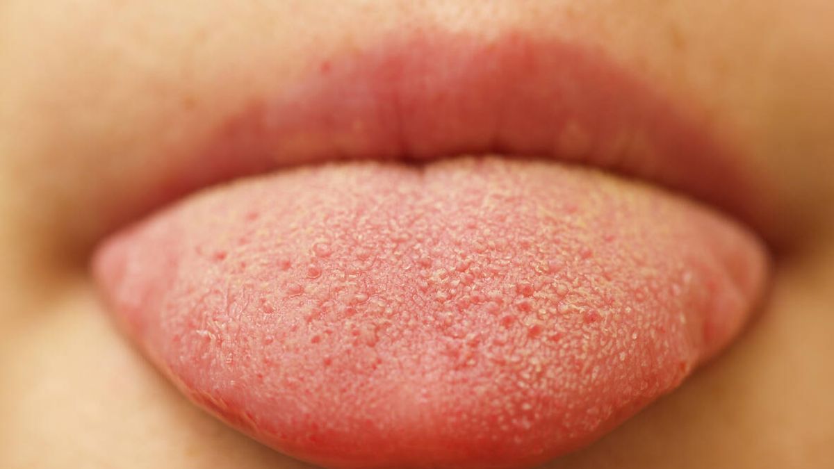 Esto es lo que el color de tu lengua dice de tu salud, según Harvard