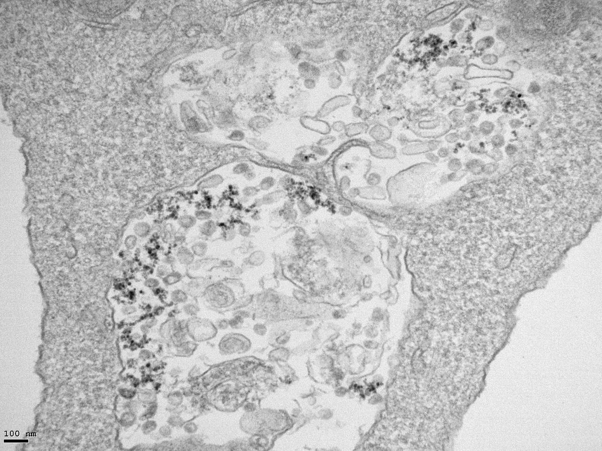 Foto: Imagen de microscopía de transmisión electrónica de células infectadas con SARS-CoV2 y tratadas con nanopartículas de óxido de hierro/ Yadileiny Portillla y Servicio de Microscopía Electrónica, CNB-CSIC.