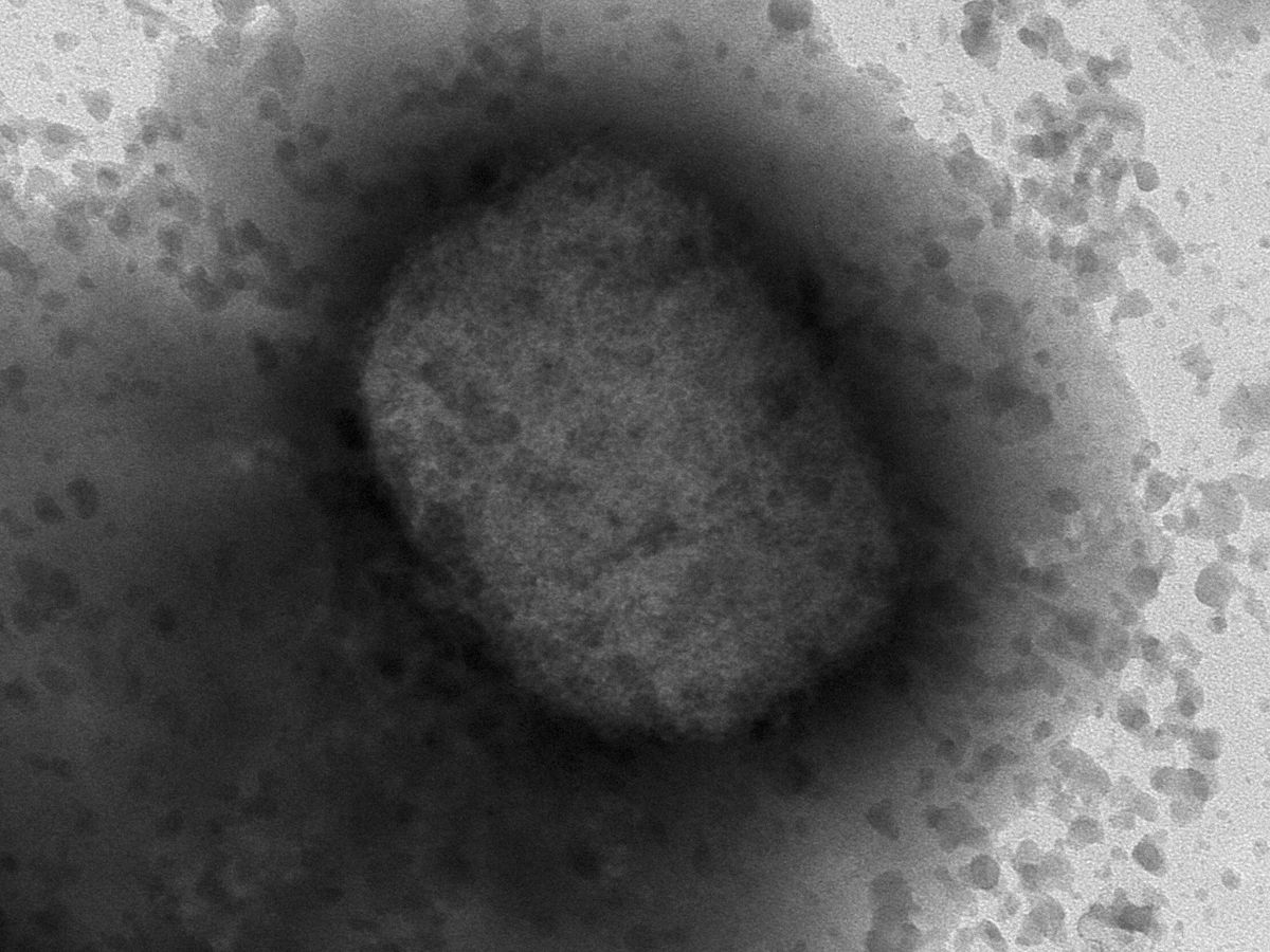 Foto: Virus de la viruela del mono por microscopía electrónica, facilitada por el Instituto de Salud Carlos III (ISCIII). (EFE/Instituto de Salud Carlos III)