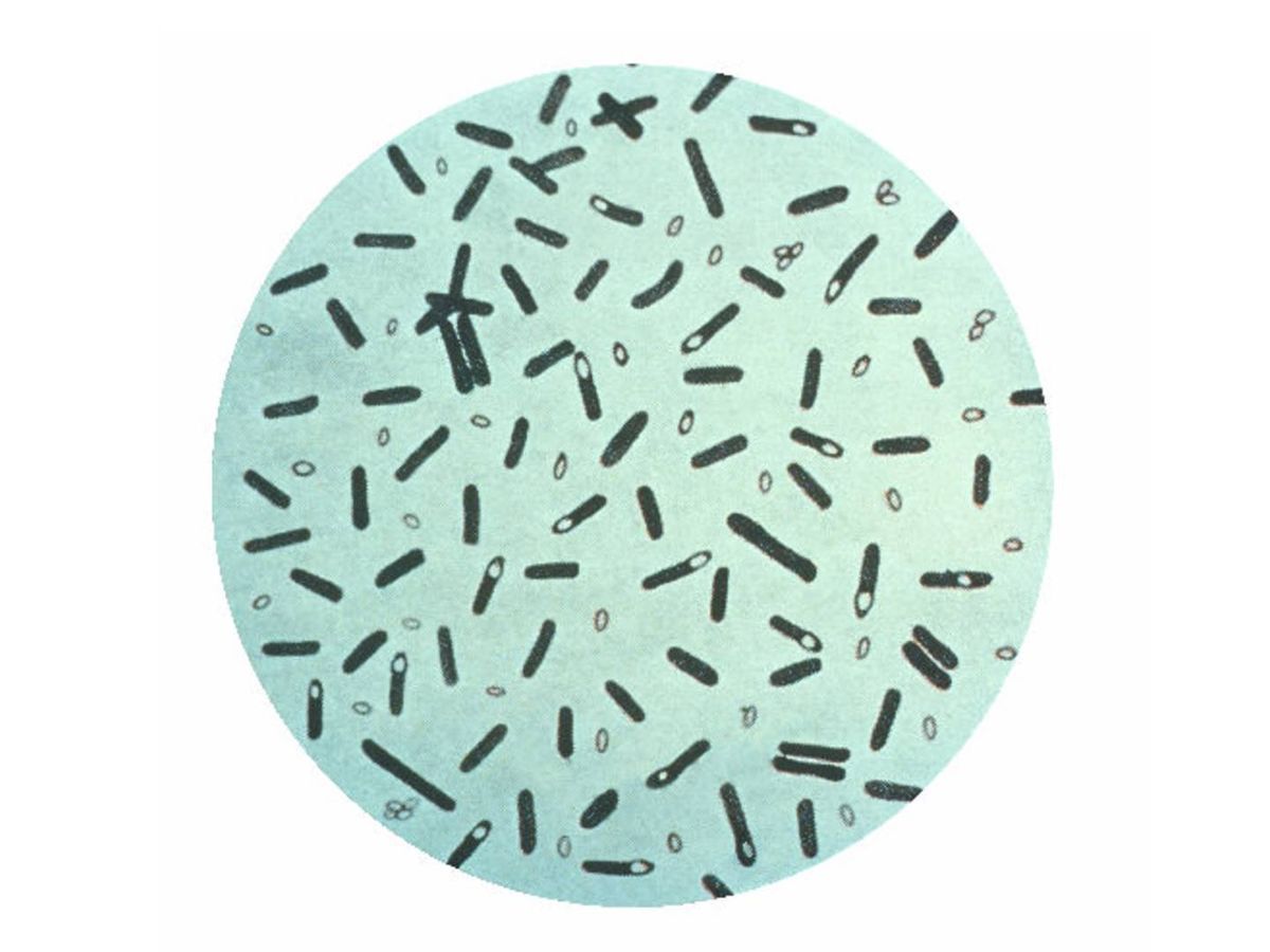Foto: Bacteria responsable de causar botulismo. (CC/Wikimedia Commons)