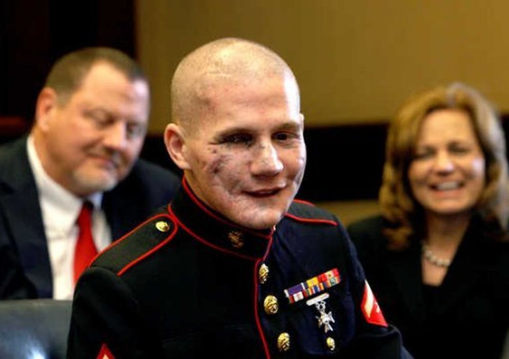 Foto: El soldado Kyle Carpenter en una imagen de archivo tomada durante su recuperación.