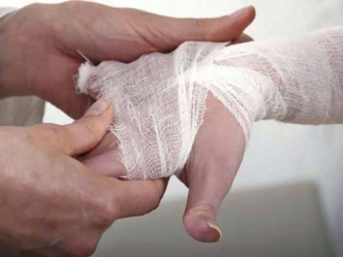 Foto: Las palmas de las manos y los dedos son dos partes fundamentales para detectar artritis reumatoide. (EFE)