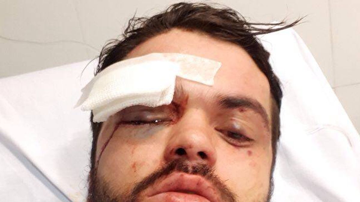 Brutal agresión homófoba a un jugador argentino de rugby 