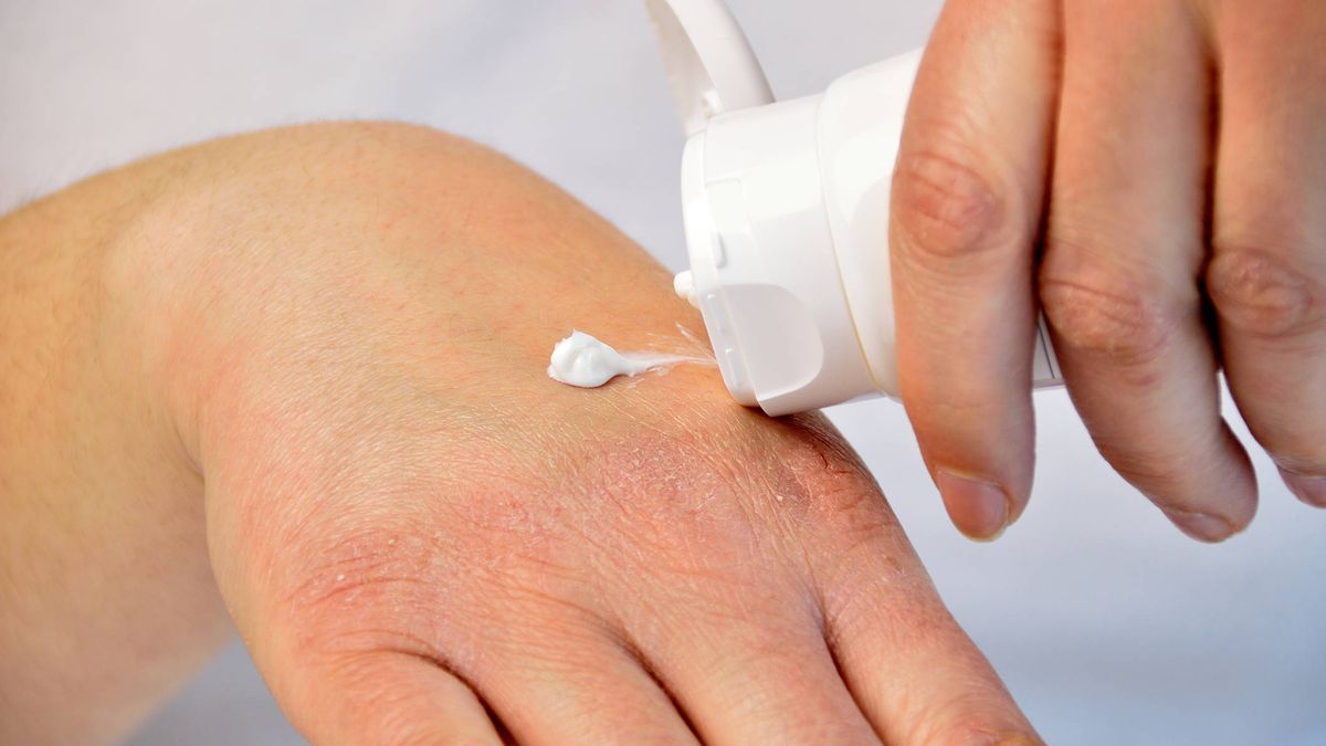 Cosas que no debes hacer a tu piel, según los dermatólogos