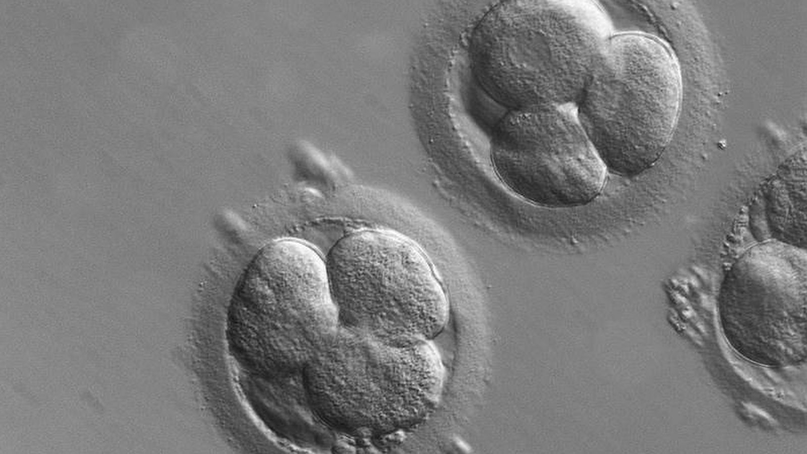 Foto: Un estudio recogido en 'Nature' a principios de agosto utilizaba CRISPR para corregir una enfermedad hereditaria en embriones (Zeiss)