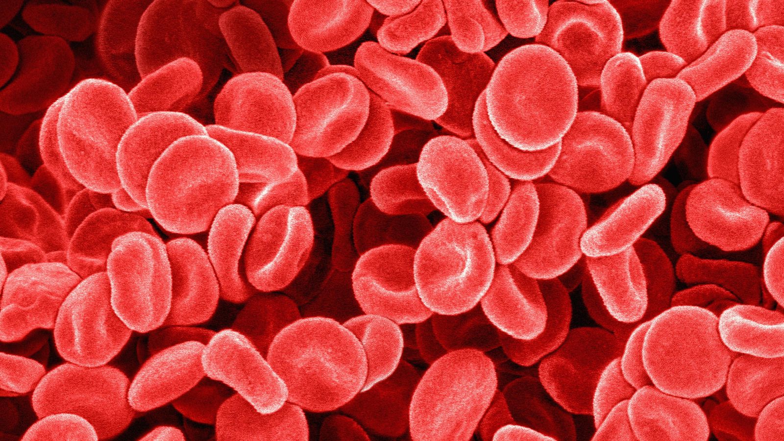 Foto: La hemofilia se caracteriza por la tendencia a sufrir hemorragias (Corbis)