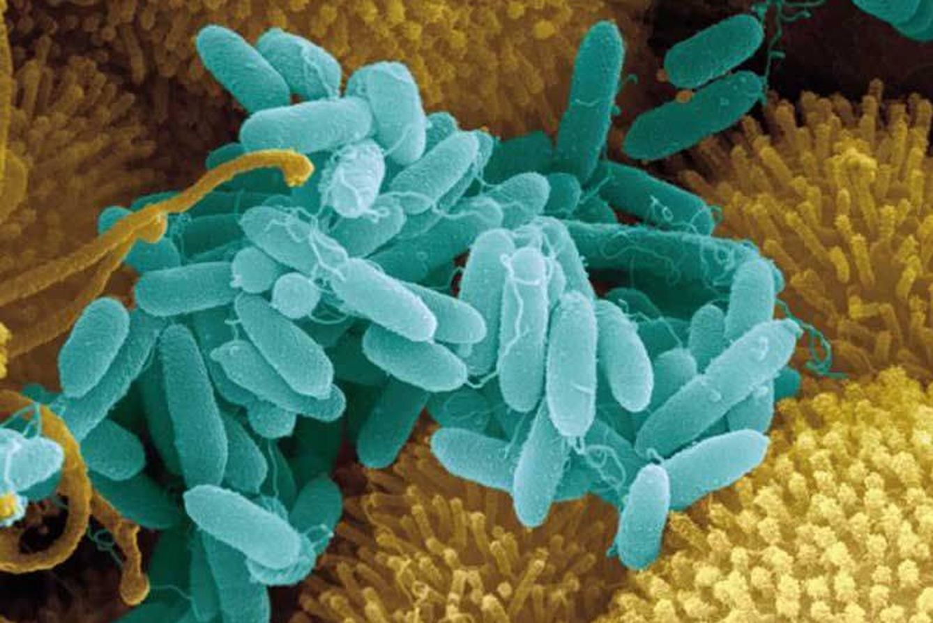 Imágenes de bacteria púrpura del azufre